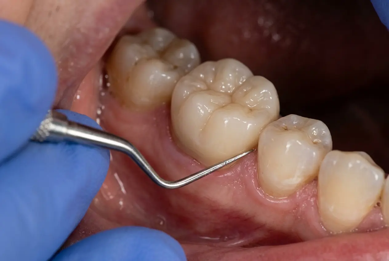 Horizon Dentist project 2